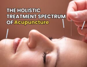 Acupuncture article cover