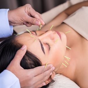 How does Acupuncture help