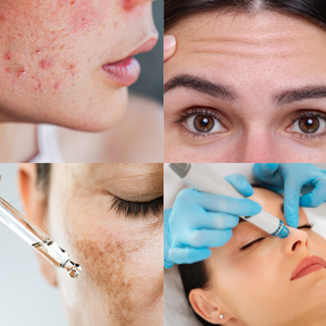 Who Can Benefit from a Hydrafacial
